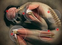 neck pain  physical therapy